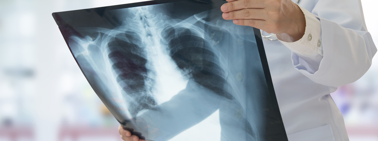 RADIOLOGYXRAYS in Benoni Peermed