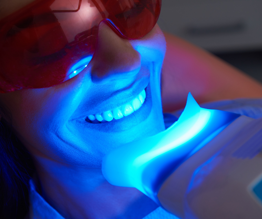 The Do’s and Don’ts After Getting Teeth Whitening